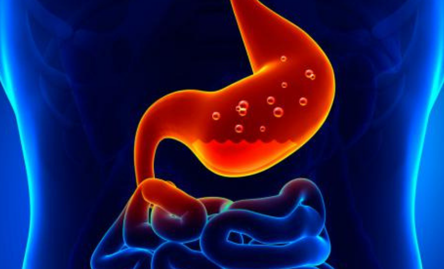 ¿Sufres de gastritis?